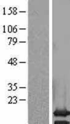 Western Blot: PCP2 Overexpression Lysate [NBL1-14187]