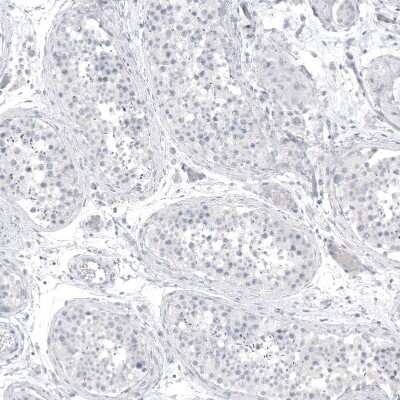 Immunohistochemistry-Paraffin: PCP4 Antibody (CL5306) [NBP2-61410]