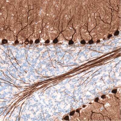Immunohistochemistry-Paraffin: PCP4 Antibody (CL5306) [NBP2-61410]