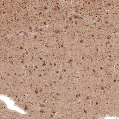 Immunohistochemistry-Paraffin: PCP4 Antibody [NBP1-80929]