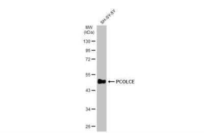 Western Blot: PCPE-1/PCOLCE Antibody [NBP1-33194]