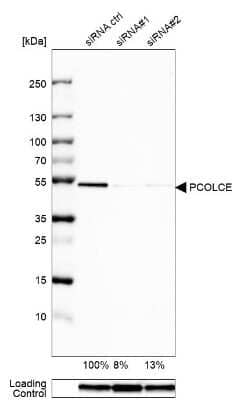 Western Blot: PCPE-1/PCOLCE Antibody [NBP2-55270]