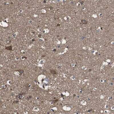 Immunohistochemistry-Paraffin: PCPTP1 Antibody [NBP1-84912]