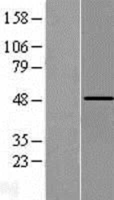 Western Blot: PCPTP1 Overexpression Lysate [NBL1-14987]