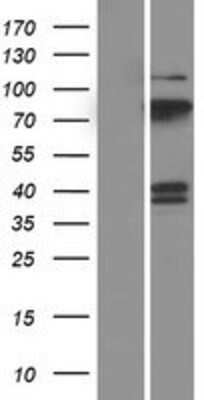 Western Blot: PCPTP1 Overexpression Lysate [NBP2-11323]