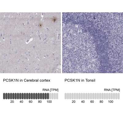 Immunohistochemistry-Paraffin: PCSK1N Antibody [NBP1-80797]