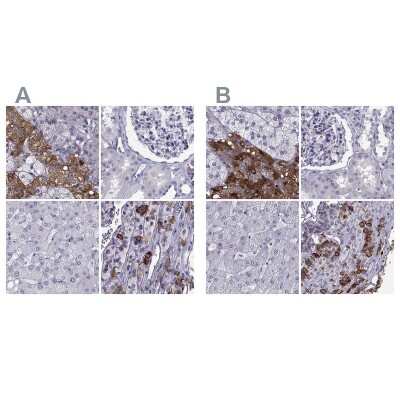 Immunohistochemistry-Paraffin: PCSK1N Antibody [NBP2-49423]