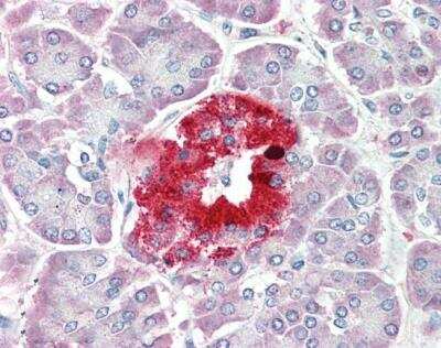 Immunohistochemistry-Paraffin: PCSK1N Antibody [NBP2-69986]