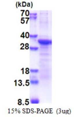 SDS-PAGE: Recombinant Human PCSK1N His Protein [NBP2-23370]