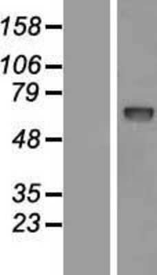 Western Blot: Proprotein Convertase 9/PCSK9 Overexpression Lysate [NBL1-14193]