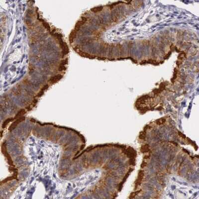 Immunohistochemistry-Paraffin: PCTAIRE1 Antibody [NBP1-92248]