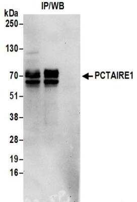 Immunoprecipitation: PCTAIRE1 Antibody [NBP2-32254]