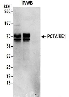 Immunoprecipitation: PCTAIRE1 Antibody [NBP2-32255]