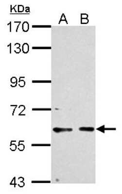 Western Blot: PCTAIRE1 Antibody [NBP2-19732]