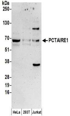 Western Blot: PCTAIRE1 Antibody [NBP2-32254]