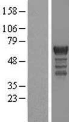 Western Blot: PCTAIRE1 Overexpression Lysate [NBL1-14194]