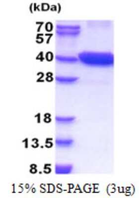 SDS-PAGE: Recombinant Human PCTAIRE1 His Protein [NBP2-22971]