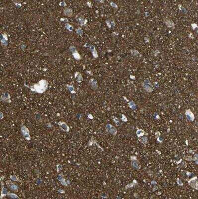 Immunohistochemistry-Paraffin: PCTAIRE2 Antibody [NBP1-87316]