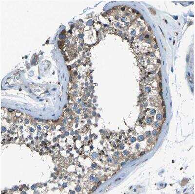 Immunohistochemistry-Paraffin: PCTAIRE2 Antibody [NBP1-87316]