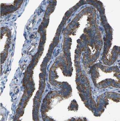 Immunohistochemistry-Paraffin: PCTAIRE2 Antibody [NBP1-87316]