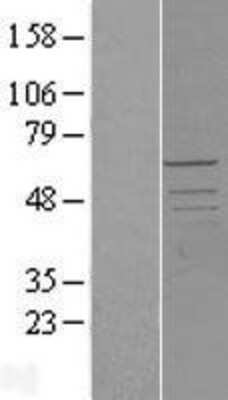 Western Blot: PCTAIRE2 Overexpression Lysate [NBL1-14195]