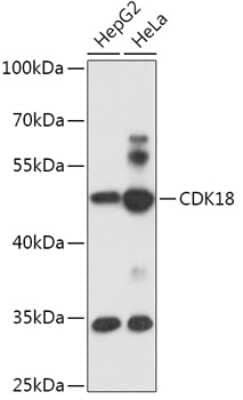 Western Blot: PCTAIRE3 AntibodyAzide and BSA Free [NBP2-94133]