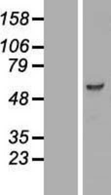 Western Blot: PCTAIRE3 Overexpression Lysate [NBL1-14196]