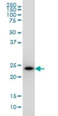 Western Blot: PCTP Antibody (1F9) [H00058488-M01]