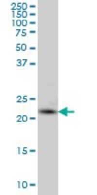 Western Blot: PCTP Antibody (3A11) [H00058488-M03]