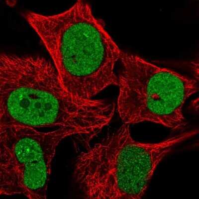 Immunocytochemistry/ Immunofluorescence: PCTP Antibody [NBP2-13742]