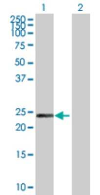 Western Blot: PCTP Antibody [H00058488-D01P]