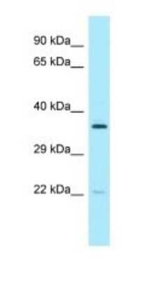 Western Blot: PCTP Antibody [NBP1-98524]