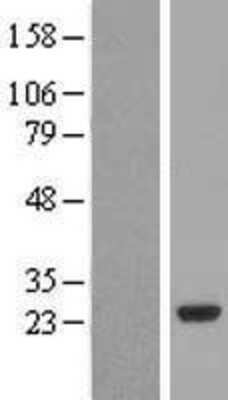 Western Blot: PCTP Overexpression Lysate [NBL1-14197]