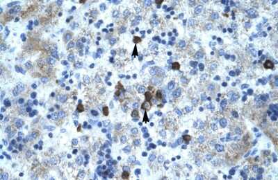 Immunohistochemistry: PCYOX1 Antibody [NBP2-88022]