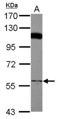 Western Blot: PCYOX1 Antibody [NBP2-19733]