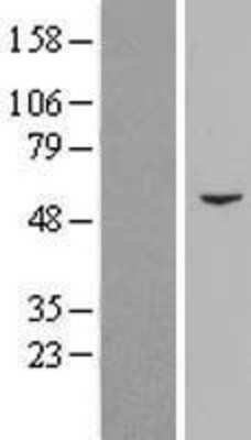 Western Blot: PCYOX1 Overexpression Lysate [NBL1-14198]