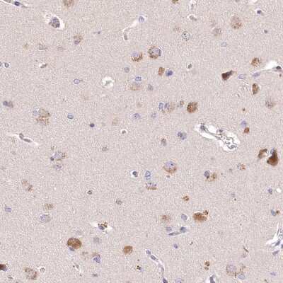 Immunohistochemistry: PCYOX1L Antibody [NBP2-31970]