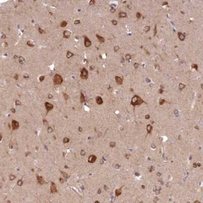 Immunohistochemistry-Paraffin: PCYOX1L Antibody [NBP1-81121]