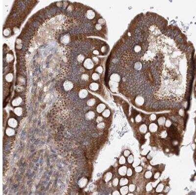 Immunohistochemistry-Paraffin: PCYOX1L Antibody [NBP1-81121]