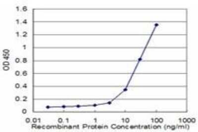 ELISA: PCYT1A Antibody (6E6) [H00005130-M02]
