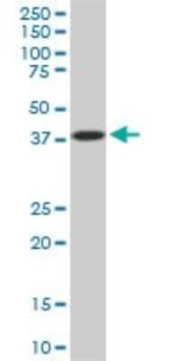 Western Blot: PCYT1A Antibody (6E6) [H00005130-M02]