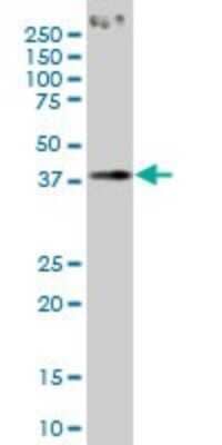 Western Blot: PCYT1A Antibody (6E6) [H00005130-M02]