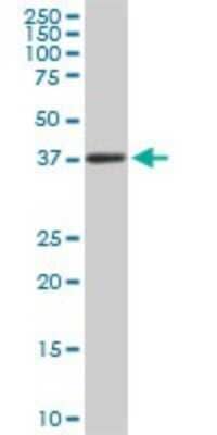 Western Blot: PCYT1A Antibody (7H8) [H00005130-M03]
