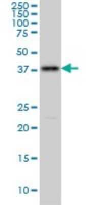 Western Blot: PCYT1A Antibody (7H8) [H00005130-M03]