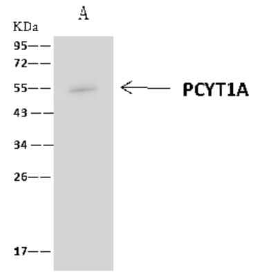 Immunoprecipitation: PCYT1A Antibody [NBP2-97692]
