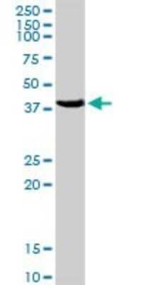 Western Blot: PCYT1A Antibody [H00005130-D01P]