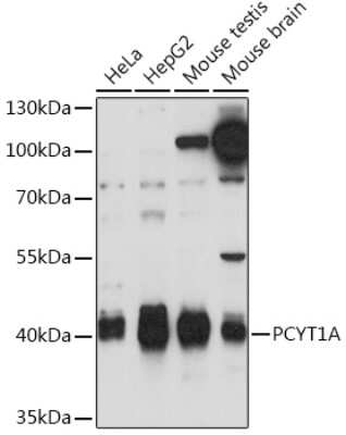 Western Blot: PCYT1A AntibodyAzide and BSA Free [NBP3-15502]