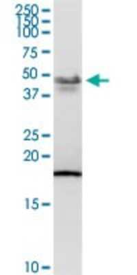 Western Blot: PCYT1B Antibody [H00009468-D01P]