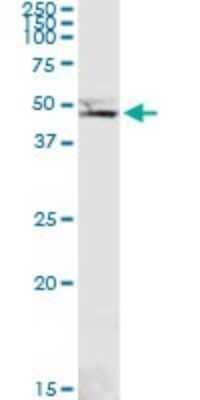 Western Blot: PCYT1B Antibody [H00009468-D01P]