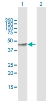 Western Blot: PCYT1B Antibody [H00009468-D01P]